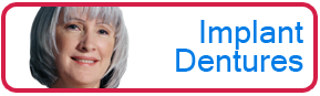 Implant Dentures